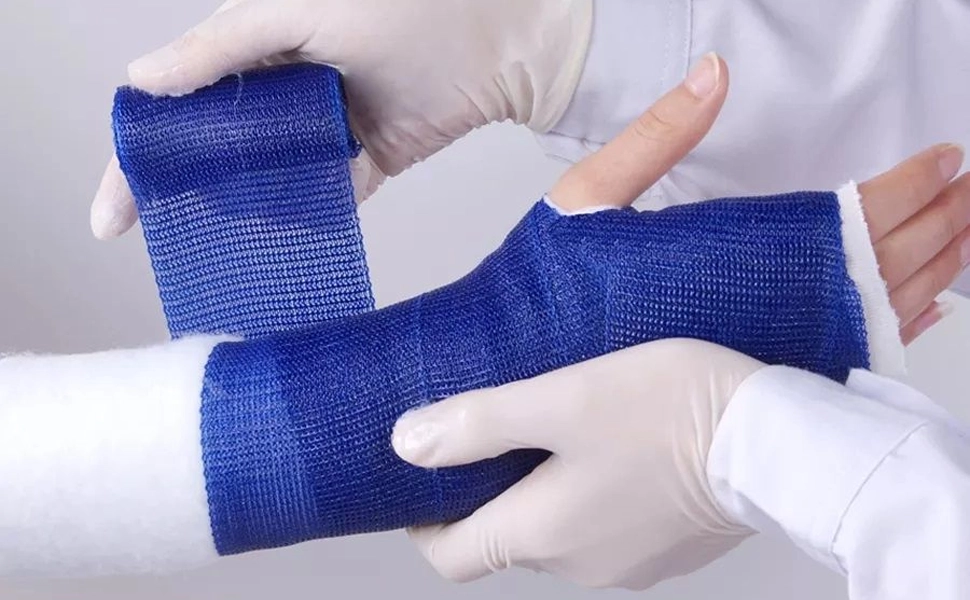 Пластиковый гипс: Современная альтернатива традиционным гипсовым повязкам